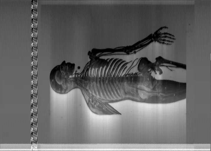 Decoded Voyager Golden Record anatomical image
